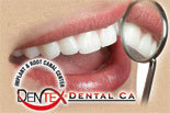 Click to Learn More about DENTEX DENTAL CA.COM